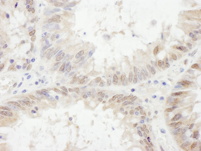 ETV6 Antibody in Immunohistochemistry (Paraffin) (IHC (P))