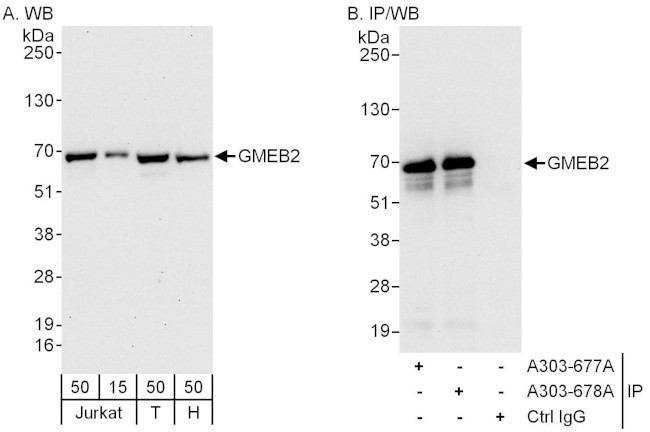 GMEB2 Antibody in Western Blot (WB)