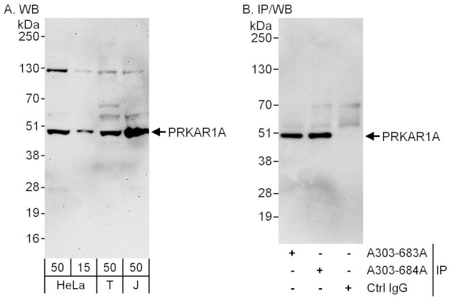 PRKAR1A Antibody in Western Blot (WB)