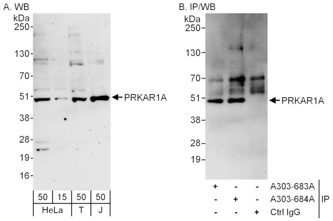 PRKAR1A Antibody in Western Blot (WB)