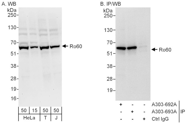 Ro60 Antibody in Western Blot (WB)