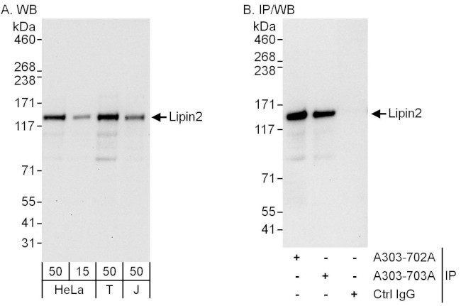 Lipin2 Antibody in Western Blot (WB)