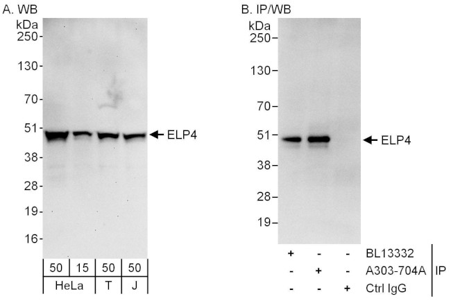 ELP4 Antibody in Western Blot (WB)