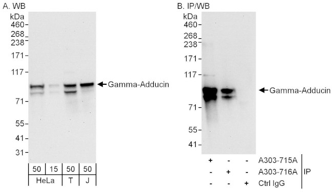 Gamma-Adducin Antibody in Western Blot (WB)