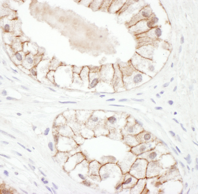 Plakoglobin Antibody in Immunohistochemistry (Paraffin) (IHC (P))