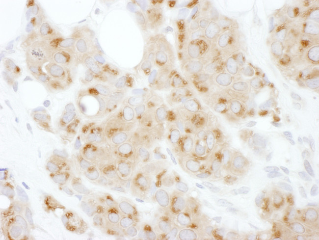 ATF6 Antibody in Immunohistochemistry (Paraffin) (IHC (P))