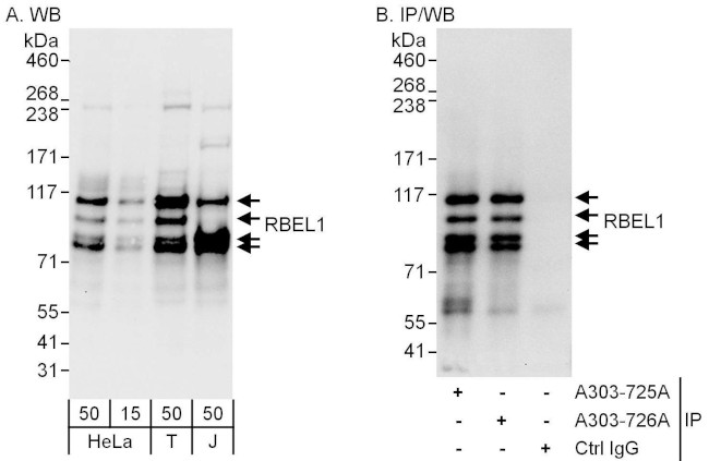 RBEL1 Antibody in Western Blot (WB)