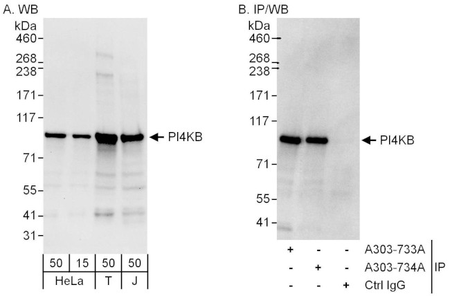PI4KB Antibody in Western Blot (WB)