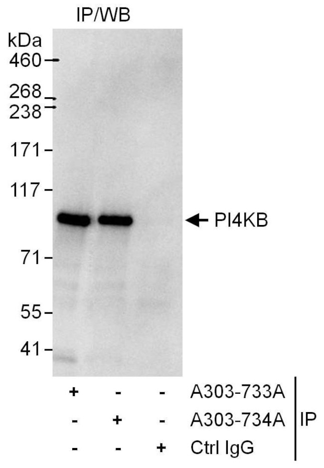 PI4KB Antibody in Immunoprecipitation (IP)