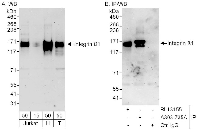Integrin Beta 1 Antibody in Western Blot (WB)
