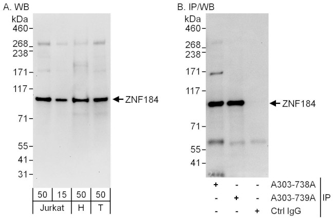 ZNF184 Antibody in Western Blot (WB)