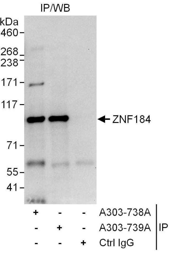 ZNF184 Antibody in Immunoprecipitation (IP)