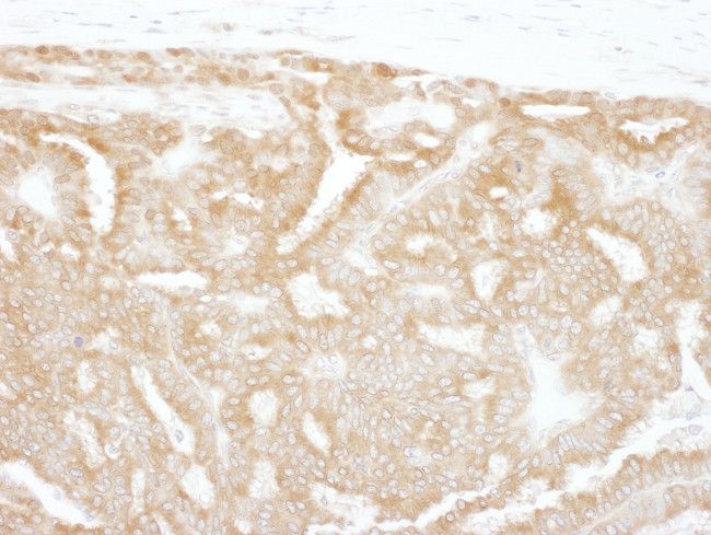 GPI Antibody in Immunohistochemistry (Paraffin) (IHC (P))