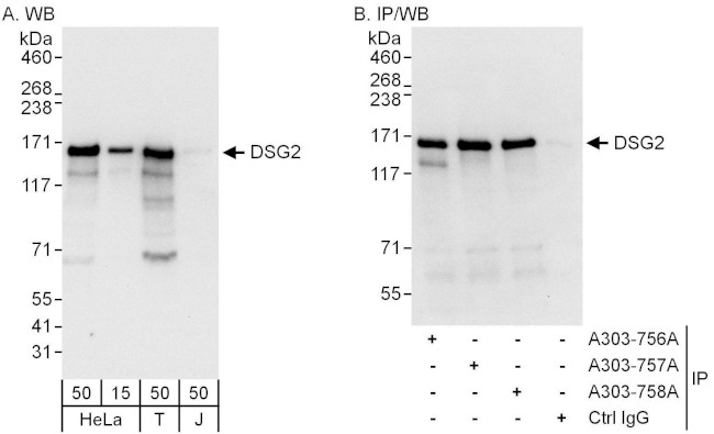 DSG2 Antibody in Western Blot (WB)
