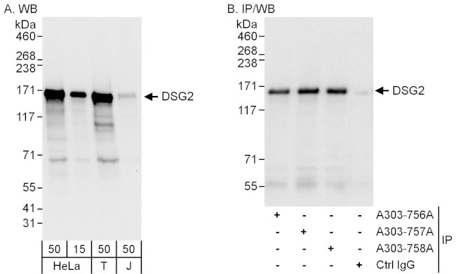 DSG2 Antibody in Western Blot (WB)