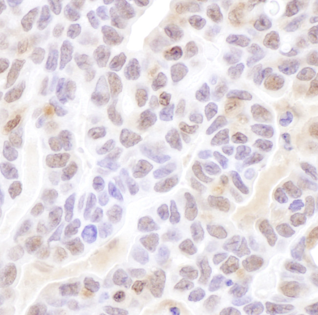Coilin Antibody in Immunohistochemistry (Paraffin) (IHC (P))