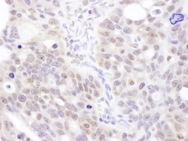 Coilin Antibody in Immunohistochemistry (Paraffin) (IHC (P))