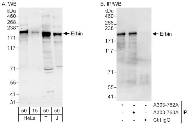 Erbin Antibody in Western Blot (WB)