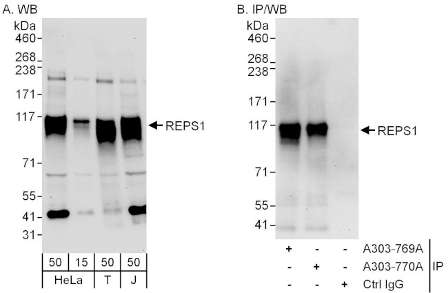 REPS1 Antibody in Western Blot (WB)