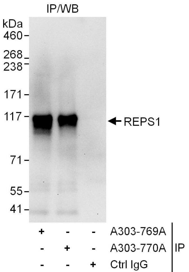 REPS1 Antibody in Immunoprecipitation (IP)