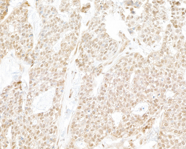 RPB3 Antibody in Immunohistochemistry (Paraffin) (IHC (P))