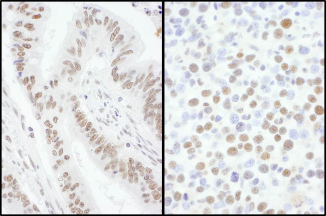 SRSF7 Antibody in Immunohistochemistry (Paraffin) (IHC (P))