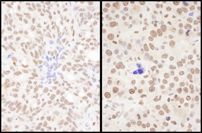 SRSF7 Antibody in Immunohistochemistry (Paraffin) (IHC (P))