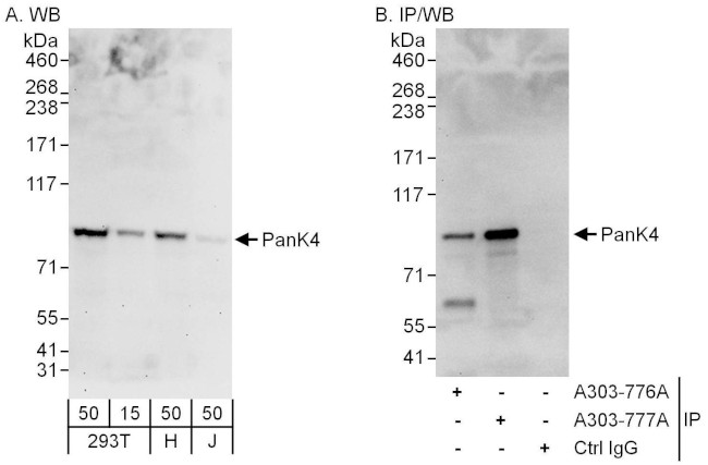 PanK4 Antibody in Western Blot (WB)