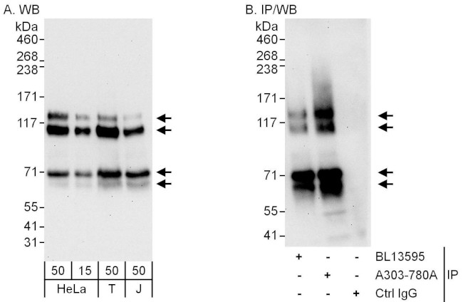 MAP7D1 Antibody in Western Blot (WB)