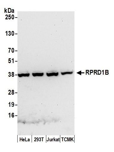 RPRD1B Antibody in Western Blot (WB)