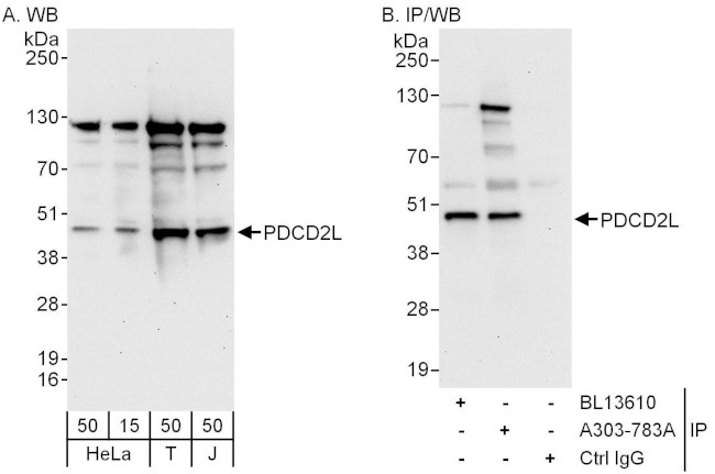 PDCD2L Antibody in Western Blot (WB)