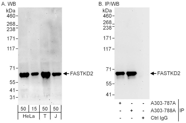 FASTKD2 Antibody in Western Blot (WB)