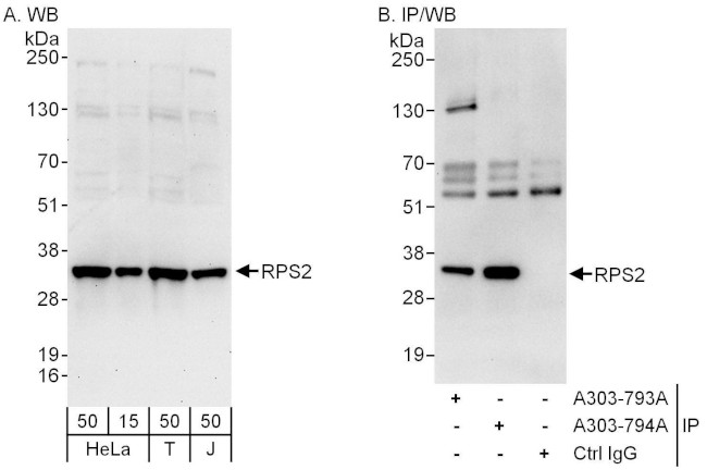 RPS2 Antibody in Western Blot (WB)