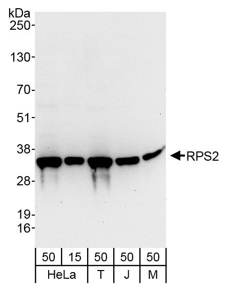 RPS2 Antibody in Western Blot (WB)