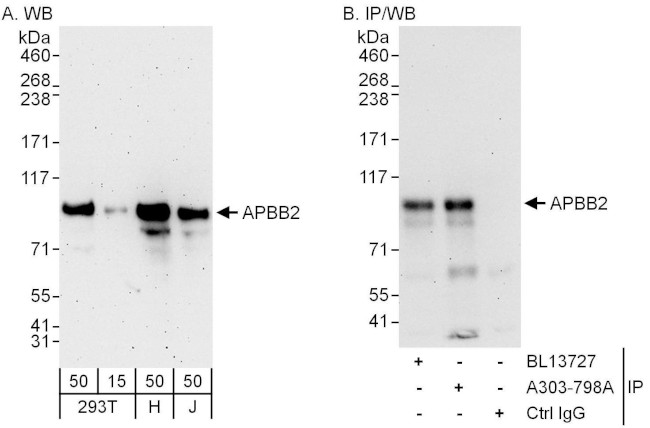 APBB2 Antibody in Western Blot (WB)