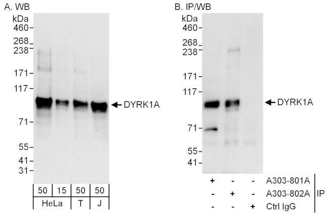 DYRK1A Antibody in Western Blot (WB)