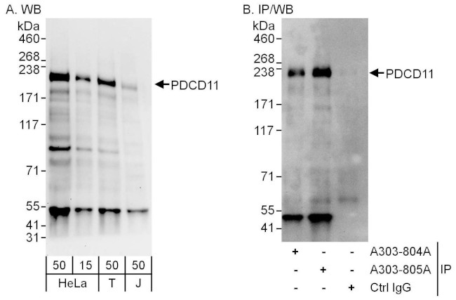 PDCD11 Antibody in Western Blot (WB)