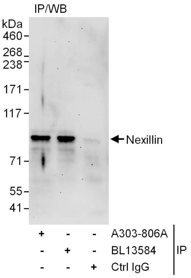Nexilin Antibody in Immunoprecipitation (IP)