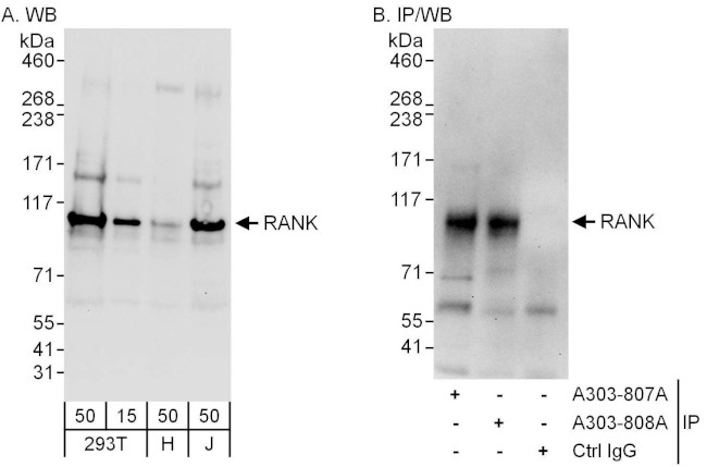 RANK Antibody in Western Blot (WB)