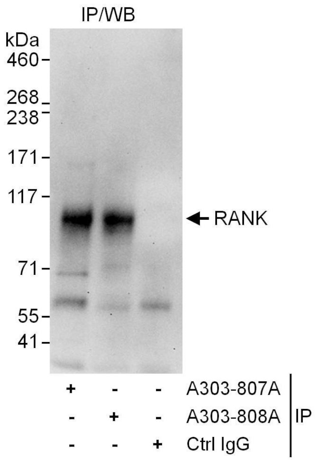 RANK Antibody in Immunoprecipitation (IP)
