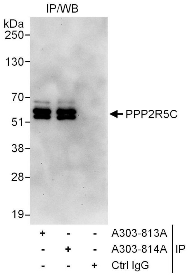 PPP2R5C Antibody in Immunoprecipitation (IP)