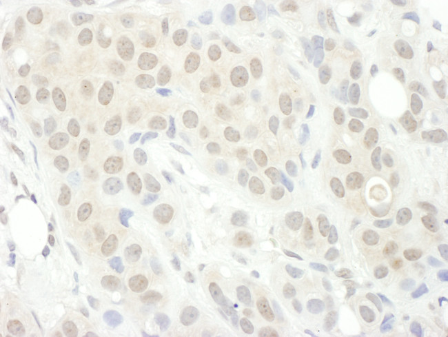 PPP2R5C Antibody in Immunohistochemistry (Paraffin) (IHC (P))