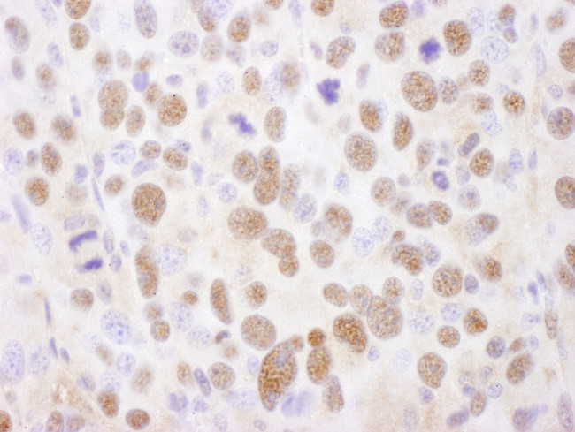 PSMA2 Antibody in Immunohistochemistry (Paraffin) (IHC (P))