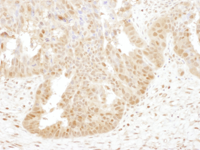 PSMB4 Antibody in Immunohistochemistry (Paraffin) (IHC (P))