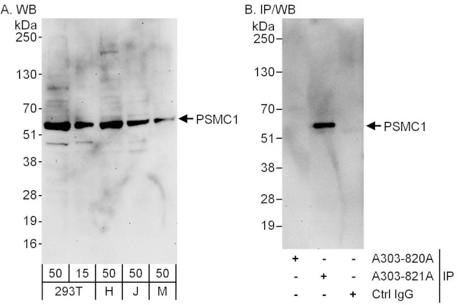 PSMC1 Antibody in Western Blot (WB)