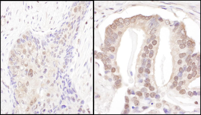 PSMD3 Antibody in Immunohistochemistry (Paraffin) (IHC (P))
