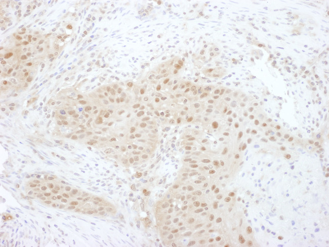 PSMD7 Antibody in Immunohistochemistry (Paraffin) (IHC (P))