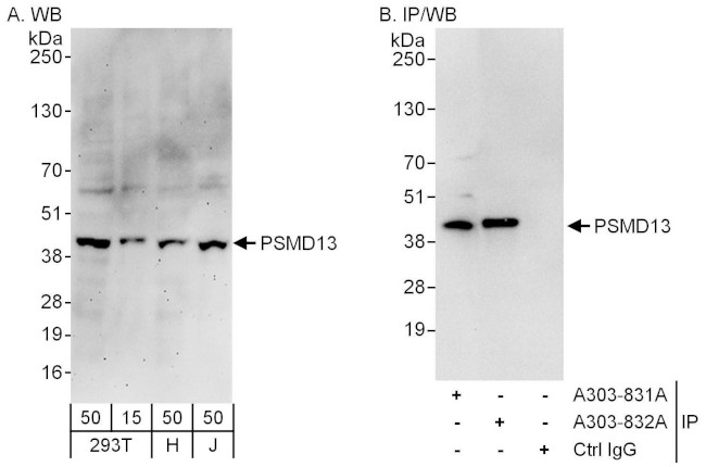 PSMD13 Antibody in Western Blot (WB)
