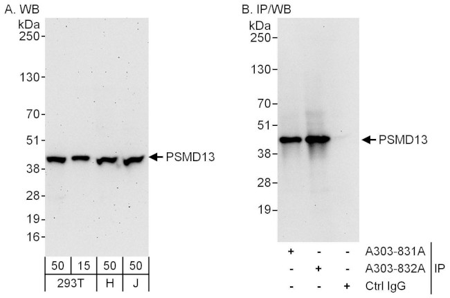 PSMD13 Antibody in Western Blot (WB)