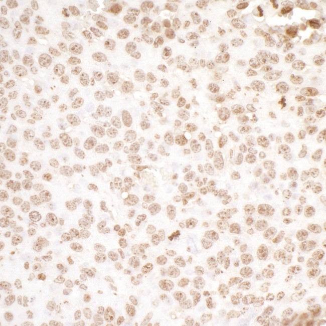 H2AX Antibody in Immunohistochemistry (Paraffin) (IHC (P))